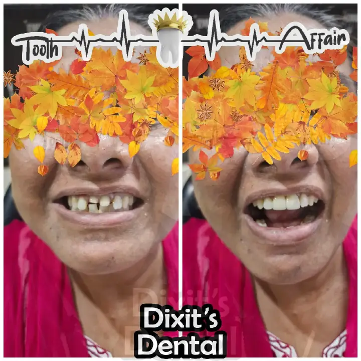Before and after